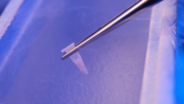 Egg freezing in Kingwood IVF